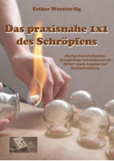 Das praxisnahe 1 x 1 des Schröpfens