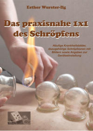 Das praxisnahe 1 x 1 des Schröpfens